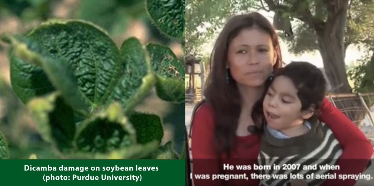 Dicamba damage on soybean leaves Birth defect boy