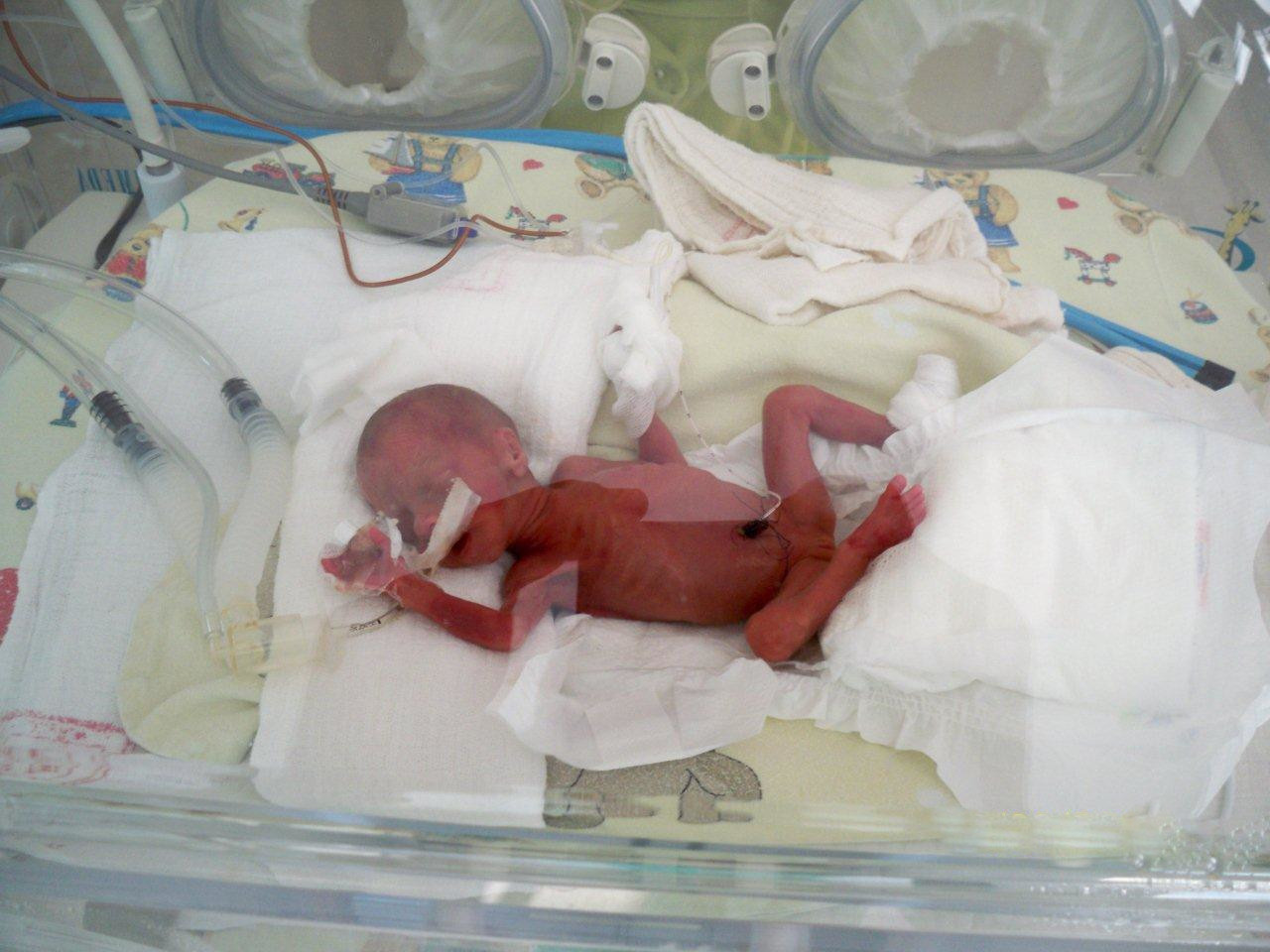 baby in incubator